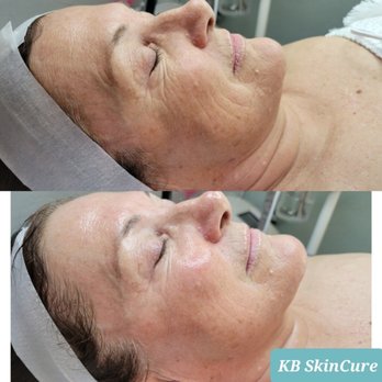 KB SkinCure - Skin Care Near Me - Scottsdale, Arizona KB SkinCure - Skin Care Near Me - Scottsdale, Arizona