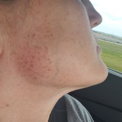 Elizabeth City Med Spa