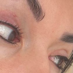 Vive Medical Spa - Sowed down under outer lash line