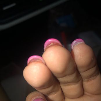 Sparadise Nails - Blood under my nails after washing still wont stop bleeding - Nail Salons Near Me - Ballwin, Missouri