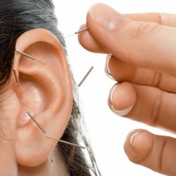 Holistic Healing Acupuncture - Acupuncture helps to detox, stress, quite smoking and weight loss.