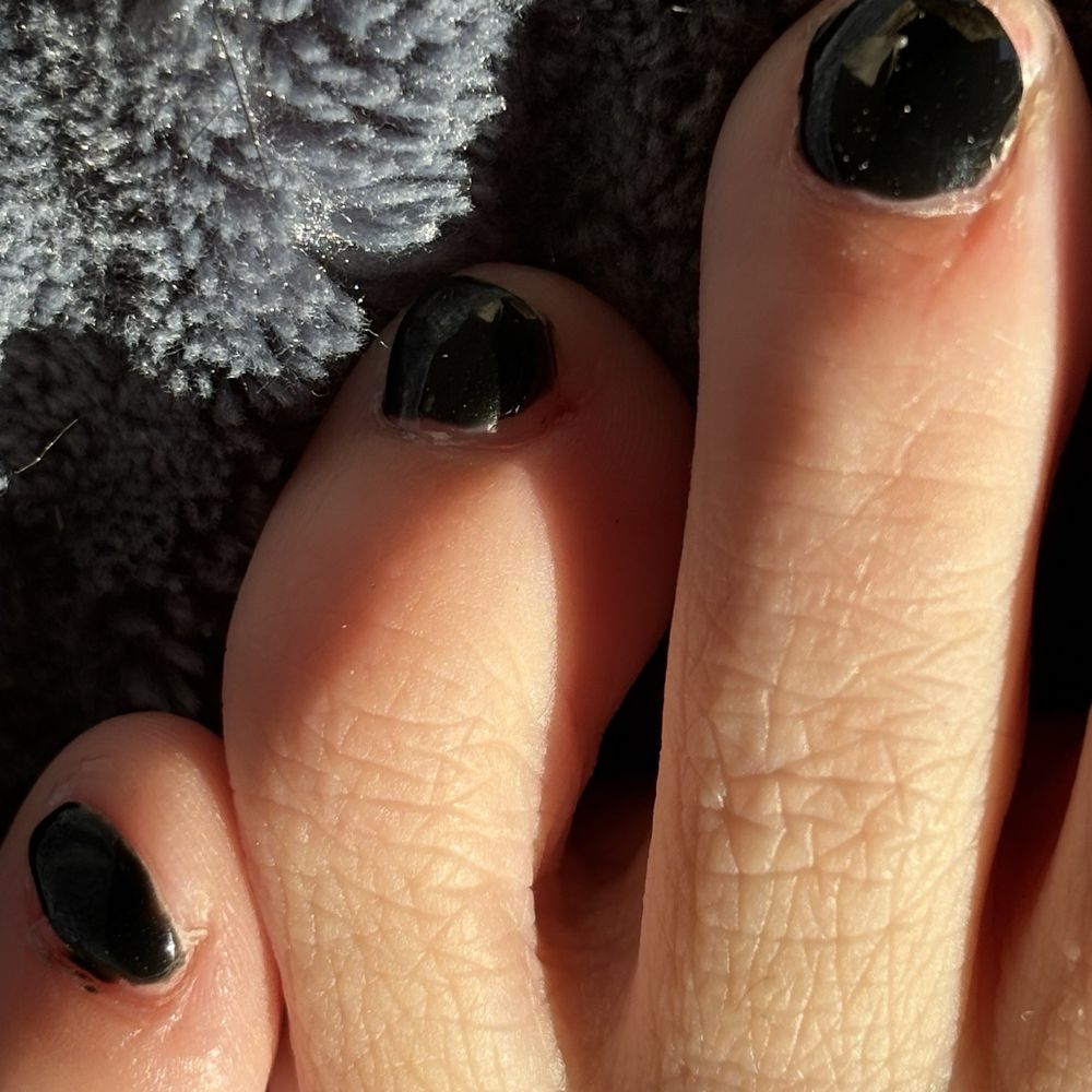 Nails and Lash - Deep cut to the right of my toe on the right - Nail Salons Near Me - Fishers, Indiana Nails and Lash - Deep cut to the right of my toe on the right - Nail Salons Near Me - Fishers, Indiana