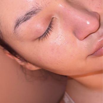 Skyn Alchemy - Hydrafacial - Skin Care Near Me - San Diego, California Skyn Alchemy - Hydrafacial - Skin Care Near Me - San Diego, California