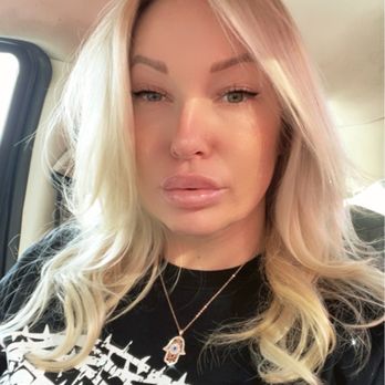 SkinSpirit - Long Beach - This was 2 days after my lips and they were amazing - Skin Care Near Me - Long Beach, California SkinSpirit - Long Beach - This was 2 days after my lips and they were amazing - Skin Care Near Me - Long Beach, California