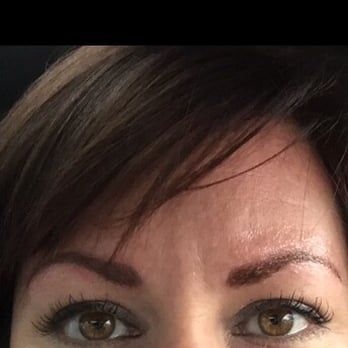 Cosmetic Solutions - 10 minutes after - Skin Care Near Me - Canonsburg, Pennsylvania