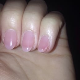 "Too short" note the deep slope the side of the pinky nail has