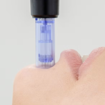 Healing Center - Microneedling is a cosmetic procedure that is available at the Healing Center - Acupuncture Near Me - Chico, California Healing Center - Microneedling is a cosmetic procedure that is available at the Healing Center - Acupuncture Near Me - Chico, California