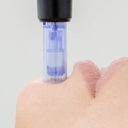 Microneedling is a cosmetic procedure that is available at the Healing Center