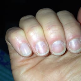 Here is my peeling polish less than 24 hours after my manicure. Notice the irritated cuticles from the overly abrasive manicure