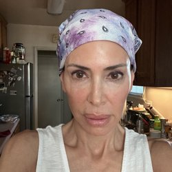 Honest Dermatology Skin & Laser Center - 2 Hours after my "Facial with Meghan"