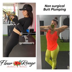 Fleur Rouge Aesthetics & Wellness MedSpa - Butt Plumping