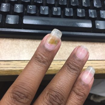 Express Nail Spa - Nail fungus "Green Nail Syndrome" result of unsanitary supplies - Nail Salons Near Me - Brandywine, Maryland