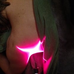 CBD Massage and Wellness - Cold Laser Shoulder