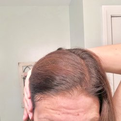 Cost Cutters - Forehead staining a day later. Patchy coloring- black roots