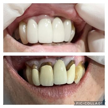 Ohana Dental - General Dentistry Near Me - Brea, California Ohana Dental - General Dentistry Near Me - Brea, California