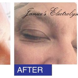 Janice's Electrolysis Clinic