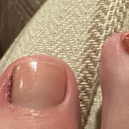 infected nail caused by pedicure at Organic Nails in Chino Ca infected nail caused by pedicure at Organic Nails in Chino Ca