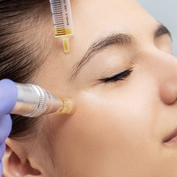 Zuri Med Spa - Platelet-Rich Plasma (PRP) Treatment - Medical Spas Near Me - Lockport, Illinois Zuri Med Spa - Platelet-Rich Plasma (PRP) Treatment - Medical Spas Near Me - Lockport, Illinois