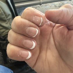 Be Nails - Chipped, peeling nails.