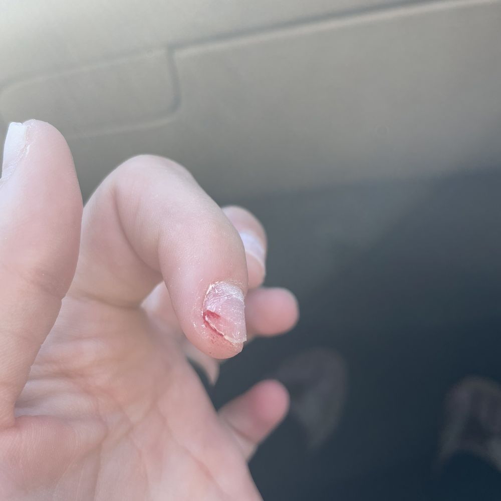 Want a fill for my acrylic nails. And got this instead thanks to JENNY the OWNER. she tore off every single acrylic nail. Want a fill for my acrylic nails. And got this instead thanks to JENNY the OWNER. she tore off every single acrylic nail.