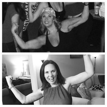 Plastic Surgery Center Of Tampa - Jaime Perez MD - Before and after- two months out! - Plastic Surgeons Near Me - Tampa, Florida Plastic Surgery Center Of Tampa - Jaime Perez MD - Before and after- two months out! - Plastic Surgeons Near Me - Tampa, Florida