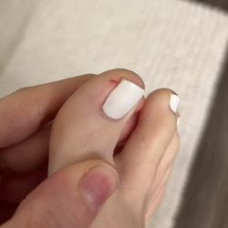 Pro Nails And Spa - Libertyville - a few hours after being cut.