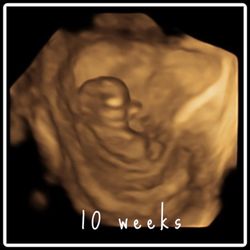Bellyssimo - 10 weeks