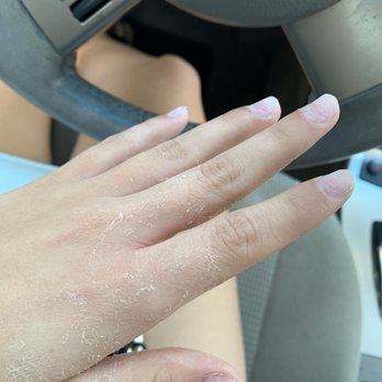 Legends Nails & Spa - The condition they left my hands in - Nail Salons Near Me - Rancho Cucamonga, California
