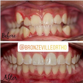 Bronzeville Orthodontics - Orthodontists Near Me - Chicago, Illinois Bronzeville Orthodontics - Orthodontists Near Me - Chicago, Illinois