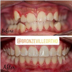 Bronzeville Orthodontics