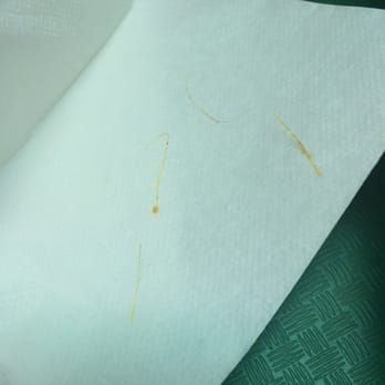 On A Roll - Chicken hair ewww - Vietnamese Near Me - San Jose, California On A Roll - Chicken hair ewww - Vietnamese Near Me - San Jose, California
