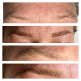 Eyebrows before and after Eyebrows before and after
