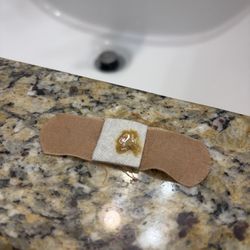 Optimal Bio - Discharge from a pellet placement wound 5 weeks after placement