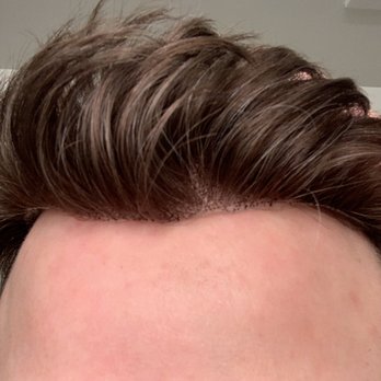 HAIRCLUB - Hair Loss Centers Near Me - Ann Arbor, Michigan HAIRCLUB - Hair Loss Centers Near Me - Ann Arbor, Michigan