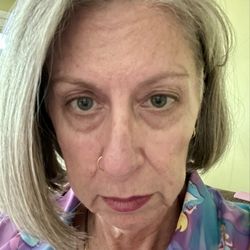 Intentional Wellness Medspa - This is my after photo. To visit and I still look like this.