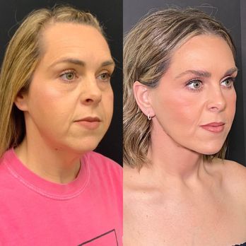 Robb Facial Plastic Surgery - Dr. Philip K. Robb Jr - Plastic Surgeons Near Me - Alpharetta, Georgia Robb Facial Plastic Surgery - Dr. Philip K. Robb Jr - Plastic Surgeons Near Me - Alpharetta, Georgia