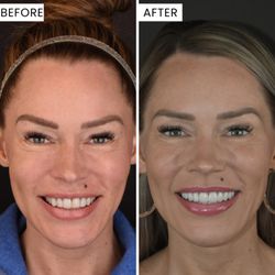 Weston Spencer, DDS Cosmetic Comprehensive Dentistry