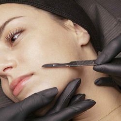 Solana Aesthetics & Wellness - Dermaplaning Facial