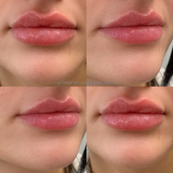 Forte Faces - Med spa in Conshohocken