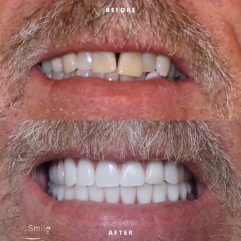 Dr Smile - smile make over - Cosmetic Dentists Near Me - San Pedro, California Dr Smile - smile make over - Cosmetic Dentists Near Me - San Pedro, California