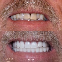 Dr Smile - Smile make over