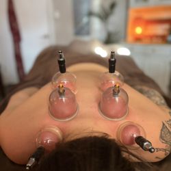 Santosha - Wellness in Motion - Cupping is an add on