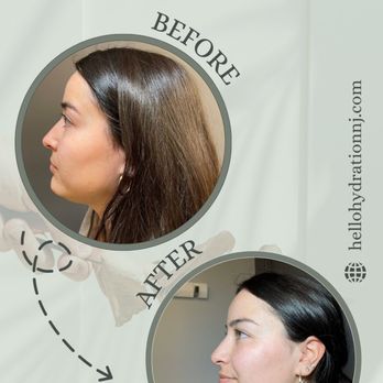 Hello Hydration - Medical Spas Near Me - Parsippany, New Jersey Hello Hydration - Medical Spas Near Me - Parsippany, New Jersey