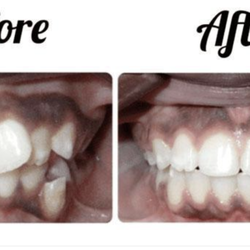 My Orthodontist - Cherry Hill