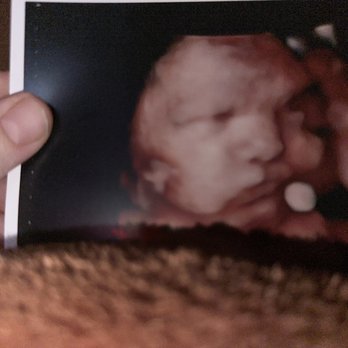 The Baby Connection - Diagnostic Imaging Near Me - Roseville, California