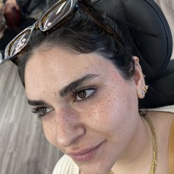 BeautyCamo - Healed freckles