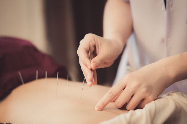 Harmon Acupuncture