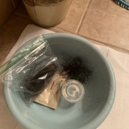 Hair Loss daily Hair Loss daily
