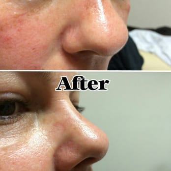 Simply You Beauty - Skin Care Near Me - Plantation, Florida Simply You Beauty - Skin Care Near Me - Plantation, Florida