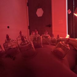 Kern Acupuncture - Cupping